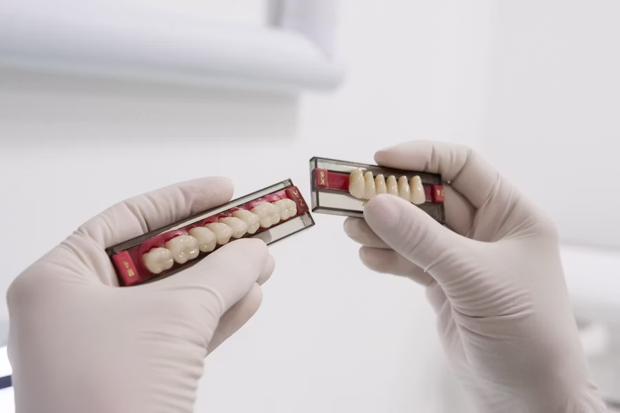 Cura dell'impianto dentale — Studio Dentistico Dr. Bedini