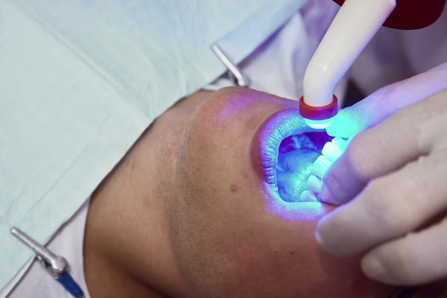 Sbiancamento denti professionale in studio — Studio Dentistico Dr. Bedini